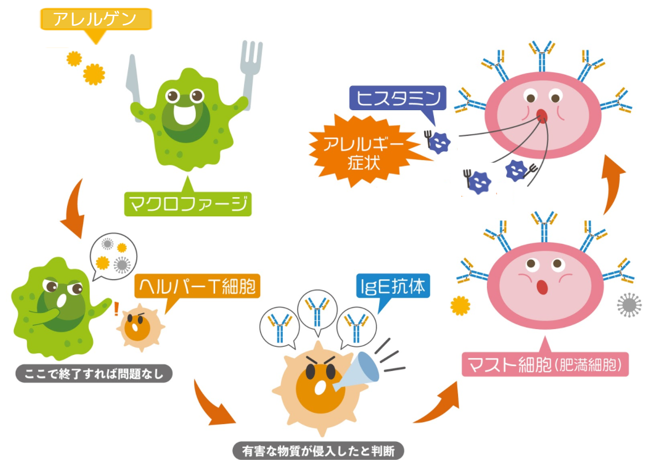 免疫のバランスが崩れると湿疹ができる そのメカニズムと肌の免疫力を高めて湿疹を防ぐ方法 やさしいlps