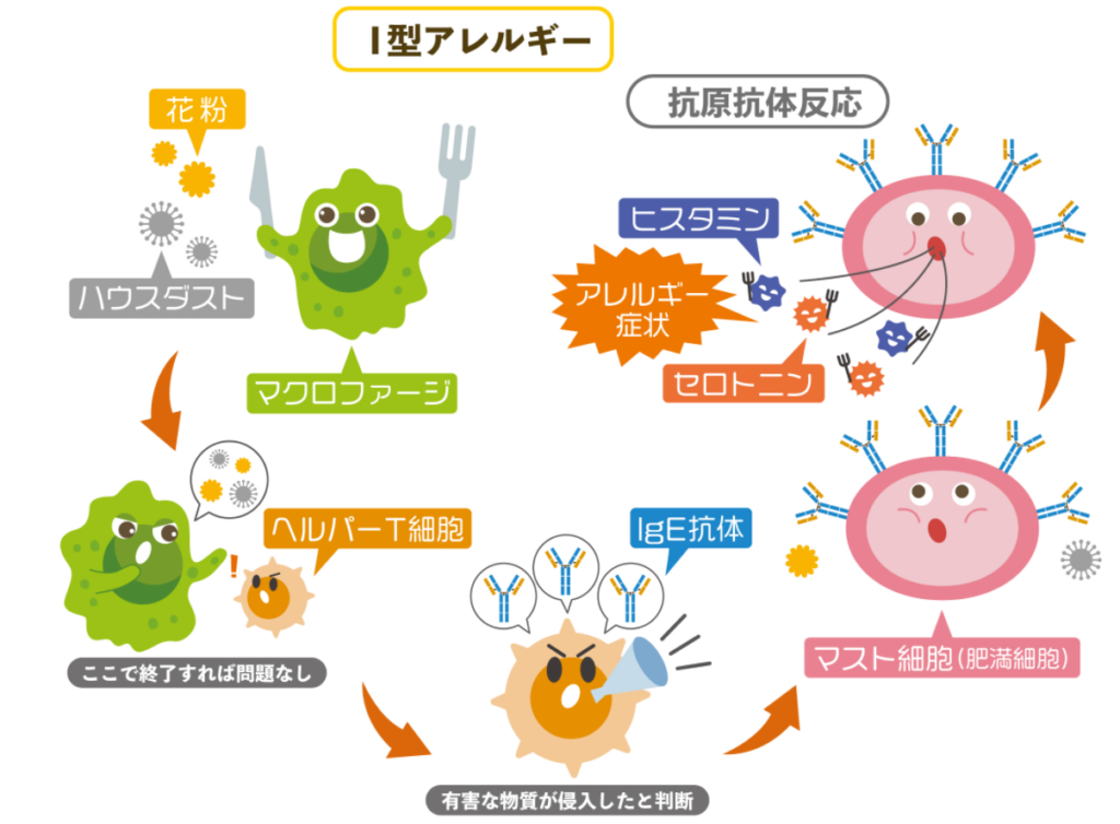 アレルギーは免疫の過剰反応によって起こる！その種類やメカニズムとは | やさしいLPS